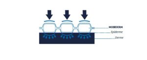 thuasne mobiderm anti oedeme schema